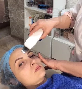 Ультразвуковая чистка лица. Коломна